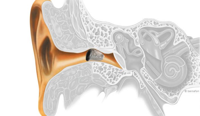 Audífonos en Sitges - Centre Auditiu de Sitges